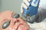 프락셀제나, 프락셀듀얼 - 미국FDA 여드름흉터 개선 승인 레이저 치료법을 알아보아요! 프락셀제나, 프락셀듀…